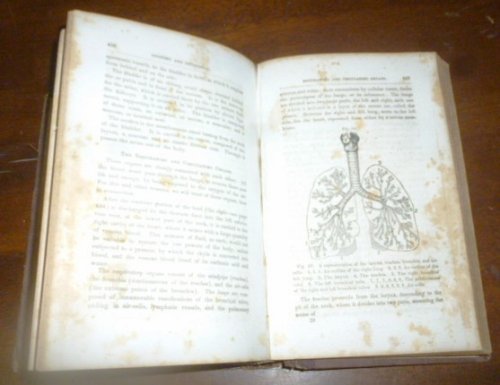Homeopathic Domestic Physician: Containing the Treatment of Diseases; with Popular Explanations of Anatomy, Physiology, Hygiene and Hydropathy: also, an Abridged Materia Media
