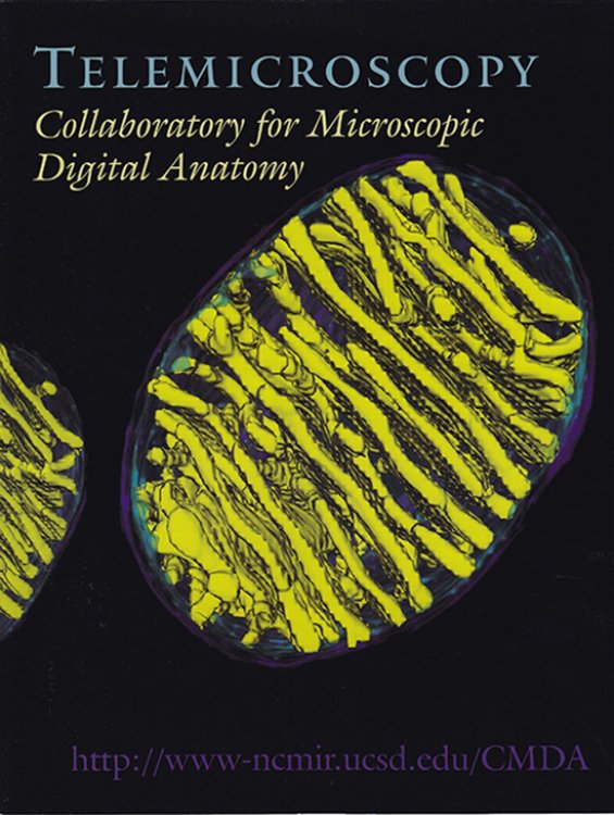 Telemicroscopy: Collaboratory for Microscopic Digital Anatomy