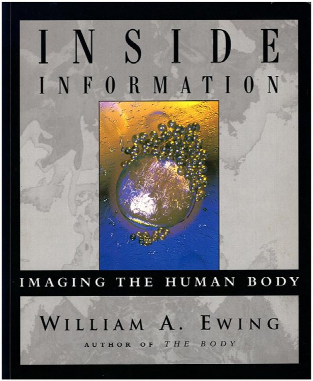 Inside Information: Imaging the Human Body