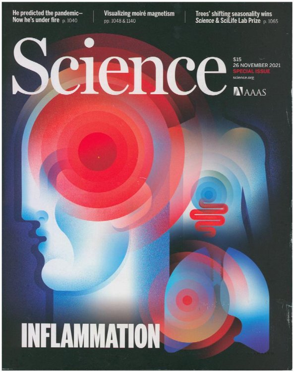 Science Magazine: Features Inflammation (26 November 2021, Vol 374, No. 6571)