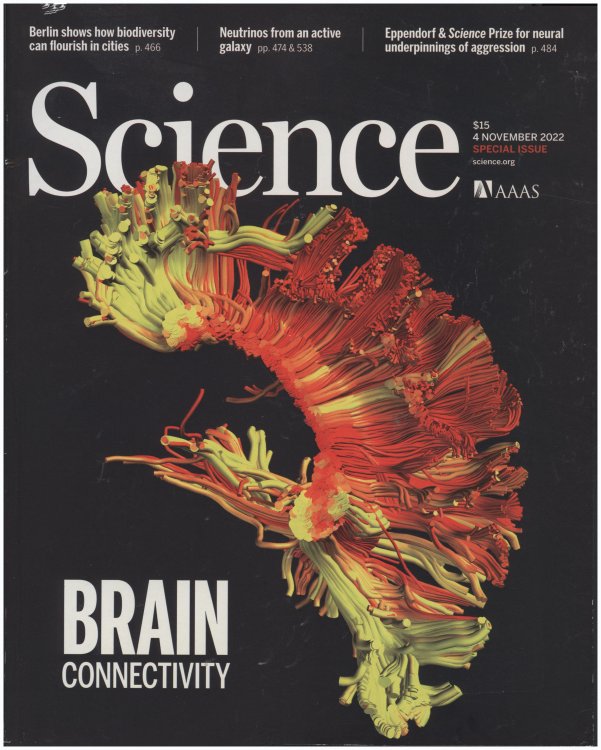Science Magazine: Brain Connectivity (4 November 2022)
