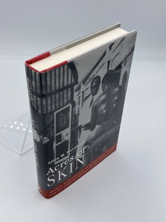 Acres of Skin Human Experiments At Holmesburg Prison