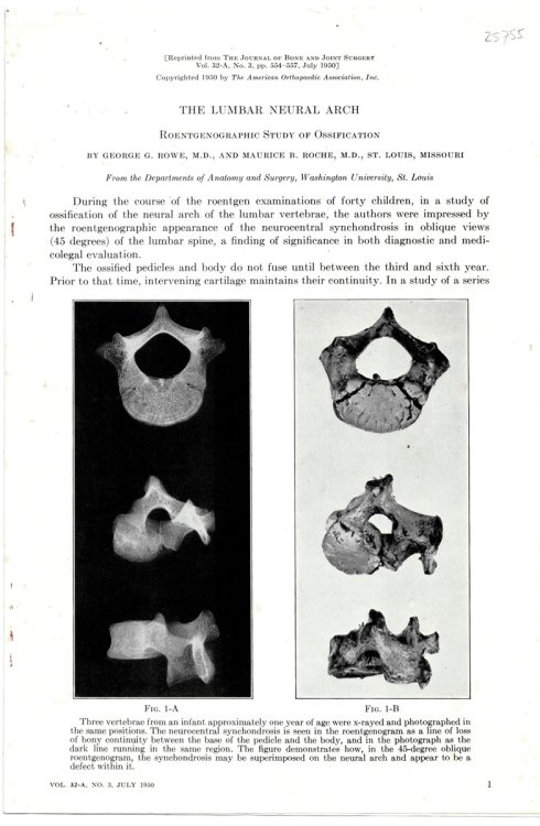 The Lumbar Neural Arch. Reprinted from the Journal of Bone and Joint Surgery Volume 32 a No. 3, July 1950