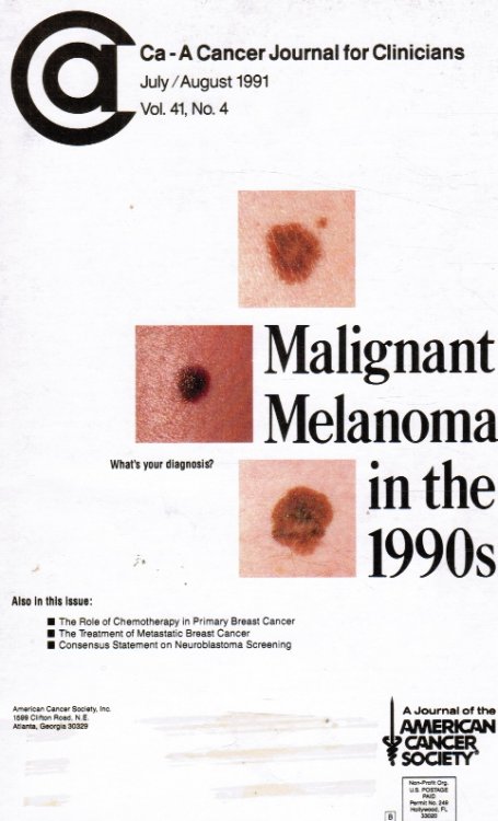 Ca-A Cancer Journal for Clinicians : Vol 41, No 4 July/Aug 1991 Malignant Melonoma in the 1990's