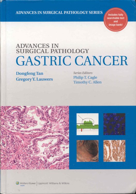 Gastric Cancer (Advances in Surgical Pathology)