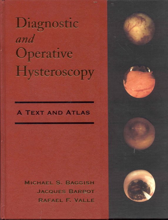 Diagnostic and Operative Hysteroscopy: A Text and Atlas