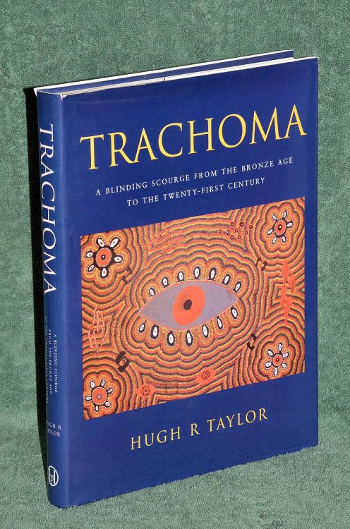 Trachoma : A Blinding Scourge From the Bronze Age to the Twenty-First Century