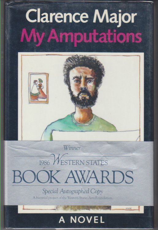My Amputations