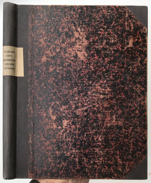 Vergleichend-diagnostischer Atlas der Hautkrankheiten und der Syphilide, einschliessend die der Haut angrenzenden Schleimhaute.