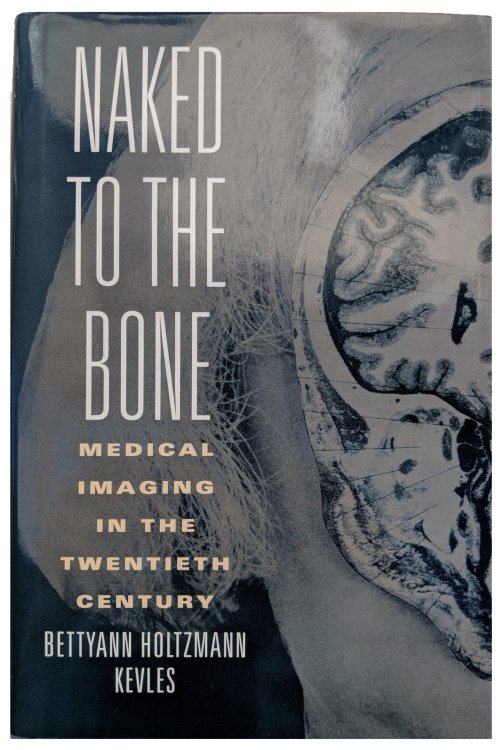 Naked to the Bone; Medical Imaging in the Twentieth Century.