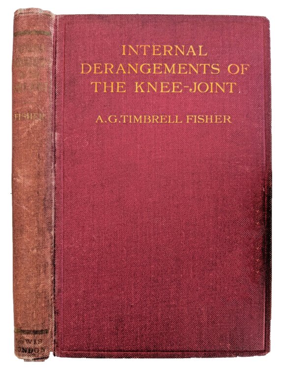 Internal Derangements of the Knee-Joint.