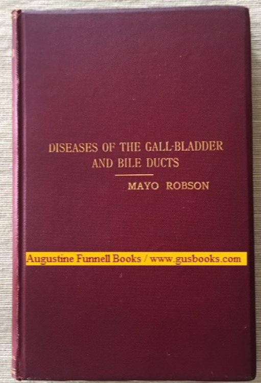 Diseases of the Gall-Bladder and Bile-Ducts