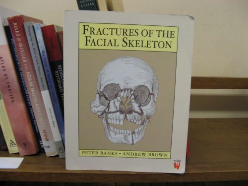 Fractures of the Facial Skeleton