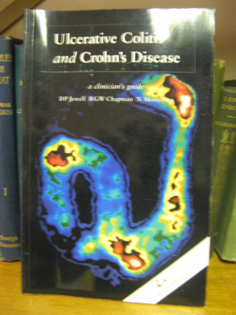 Ulcerative Colitis and Crohn's Disease
