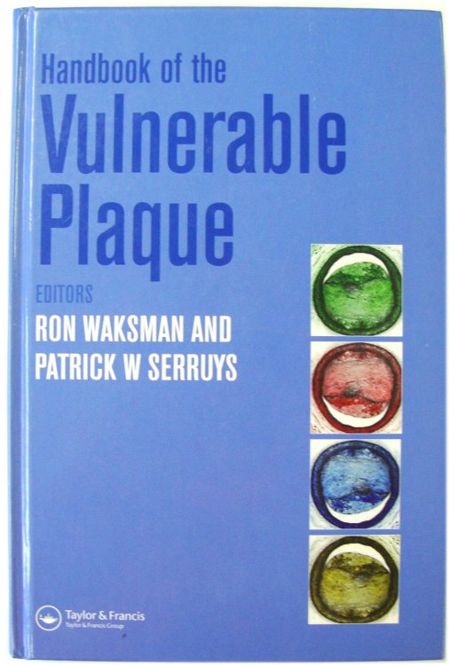 Handbook of the Vulnerable Plaque