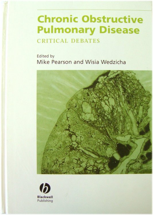 Chronic Obstructive Pulmonary Disease: Critical Debates