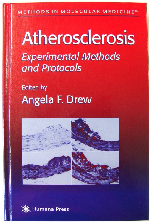 Atherosclerosis: Experimental Methods and Protocols