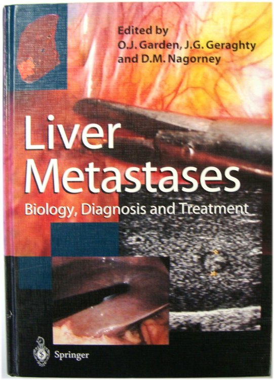 Liver Metastases: Biology, Diagnosis and Treatment