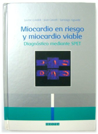 Miocardio en riesgo y miocardio viable: DIAGNOSTICO mediante SPET