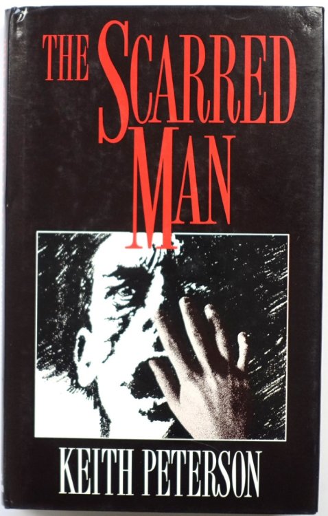 The Scarred Man