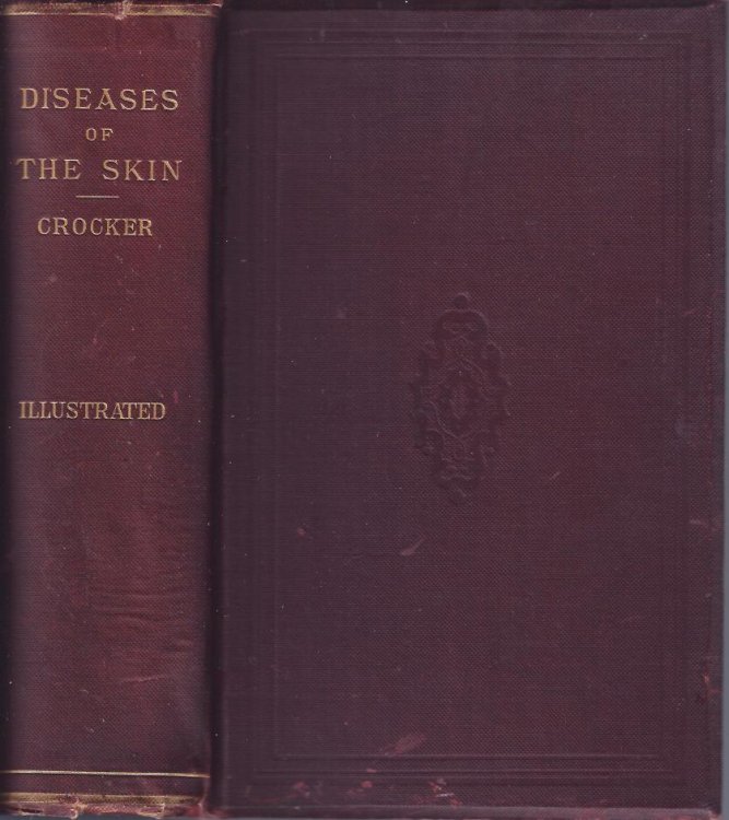 Diseases of the Skin :Their Description, Pathology, Diagnosis, and Treatment with Special Reference to the Skin Eruptions of Children