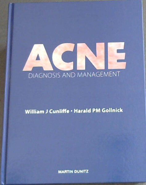 Acne: Diagnosis and Management