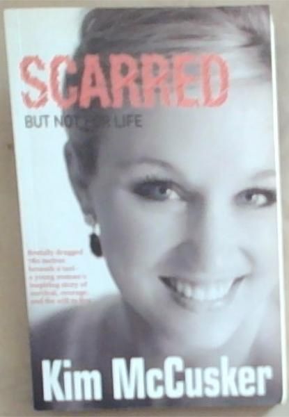 Scarred: But Not For Life