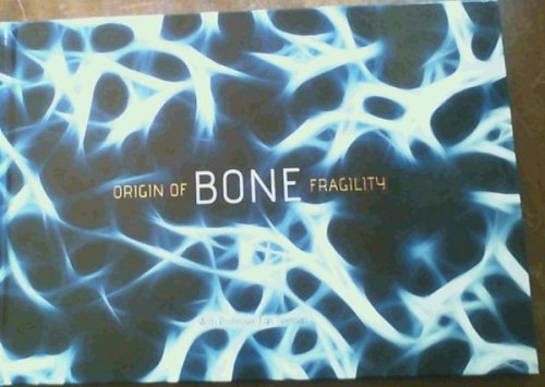Origin of Bone Fragility