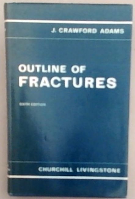Outline of fractures, including joint injuries