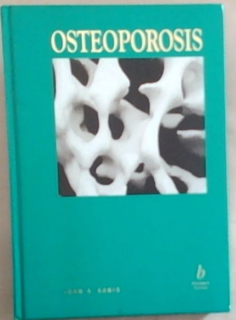 Image for Osteoporosis Osteoporosis
