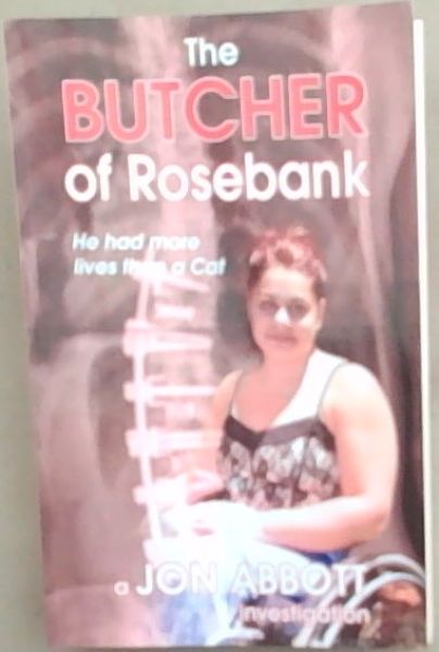 The Butcher of Rosebank