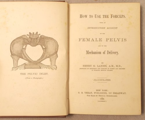 How to Use the Forceps: with an Introductory Account of the Female Pelvis and of the Mechanism of Delivery