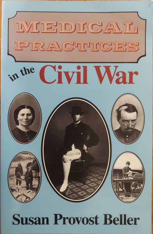 Medical Practices in the Civil War