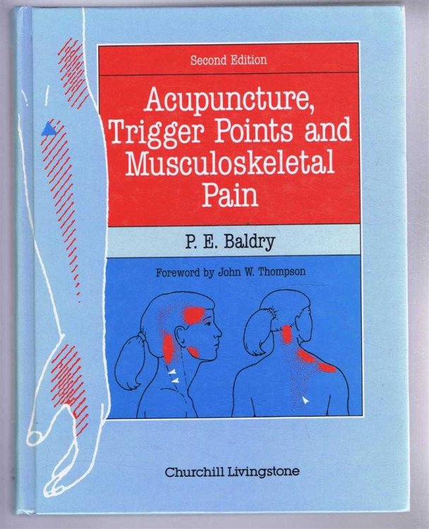 Acupuncture, Trigger Points and Musculoskeletal Pain