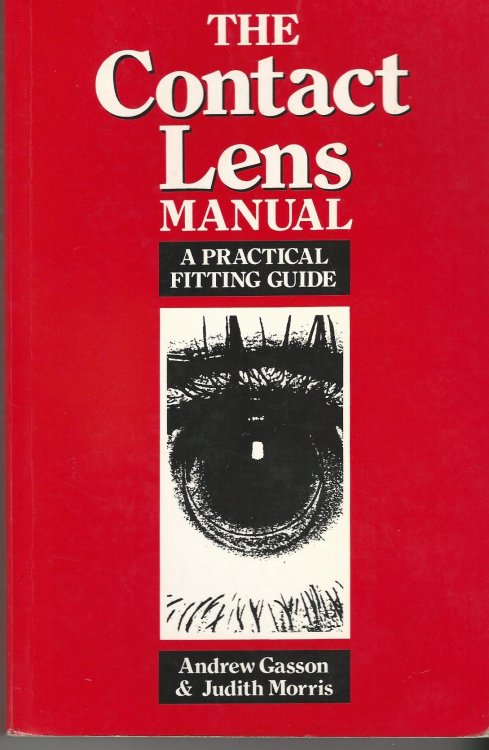 The Contact Lens Manual: A Practical Fitting Guide.