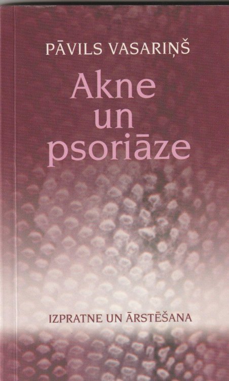 Akne Un Psoriaze Izpratne Un Arstesana