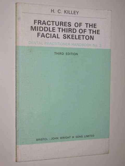 Fractures Of The Middle Third Of The Facial Skeleton