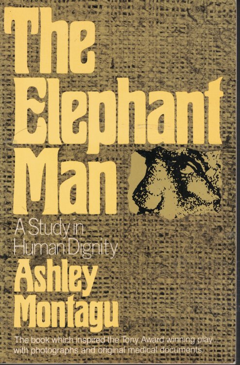 Elephant Man - Study In Human Dignity