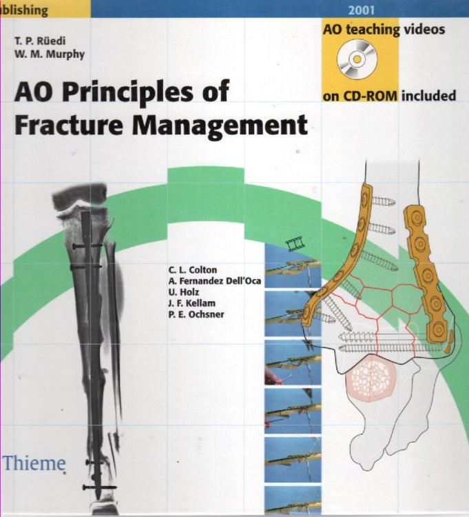 AO Principles of Fracture Management