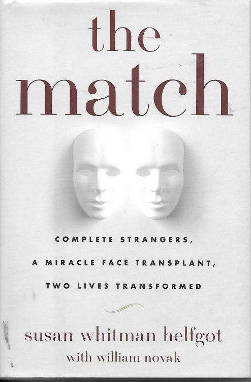 The Match Complete Strangers, a Miracle Face Transplant, Two Lives Transformed