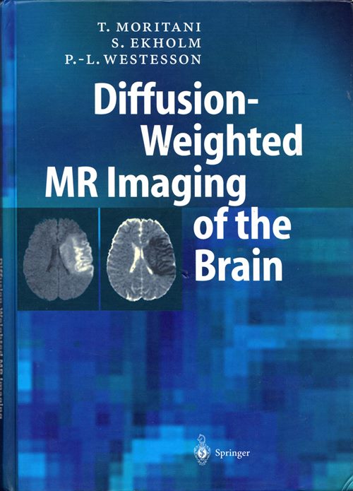 Diffusion-Weighted MR Imaging of the Brain