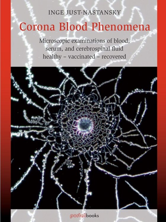 Corona Blood Phenomena Microscopic examinations of blood, serum, and cerebrospinal fluid: healthy – vaccinated – recovered