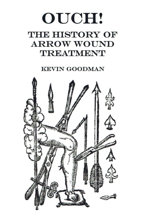 OUCH! THE HISTORY OF ARROW WOUND TREATMENT (SIGNED COPY)