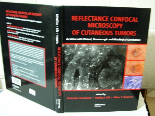 Reflectance Confocal Microscopy of Cutaneous Tumors: An Atlas with Clinical, Dermoscopic and Histological Correlations