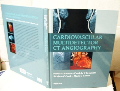 Cardiovascular Multidetector CT Angiography