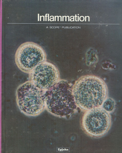 INFLAMMATION A Scope Publication