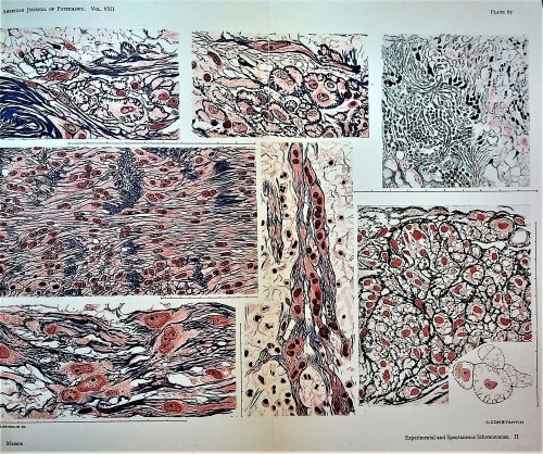 Experimental and spontaneous schwannomas (peripheral gliomas). I. Experimental schwannomas; II. Spontaneous schwannomas