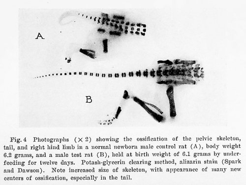 Structural changes when growth is suppressed by undernourishment in the albino rat TOGETHER WITH 4 additional offprints