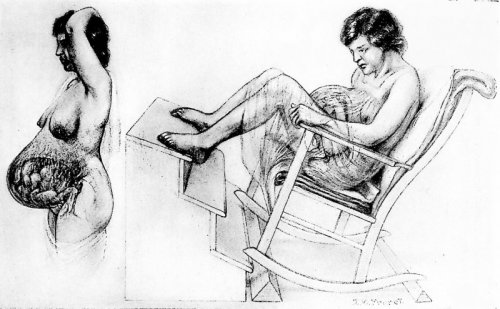 Postures & Practices During Labor Among Primitive Peoples. Adaptations to Modern Obstetrics; With Chapters on Taboos & Superstitions & Postpartum Gymnastics
