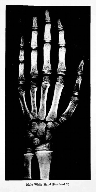 Atlas of Skeletal Maturation
